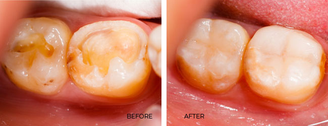 Before After Case 05